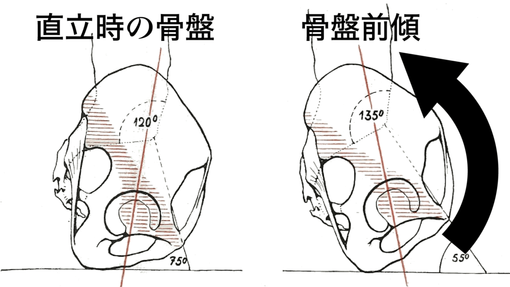 長崎県南島原市で利用者数最多のダイエットフィットネスクラブZUTTOWAKAIの太田祥平チーフトレーナーがデッドリフトのやり方を教示するため用意した図。直立時の骨盤と骨盤前傾を比較している